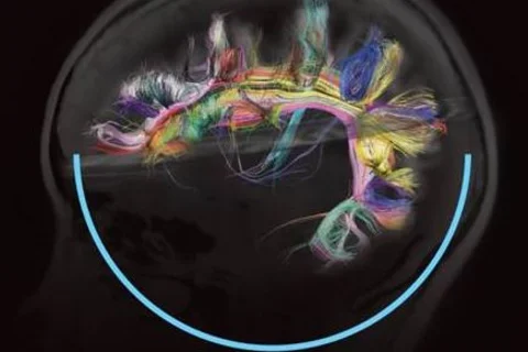 The Brain Iniatiative