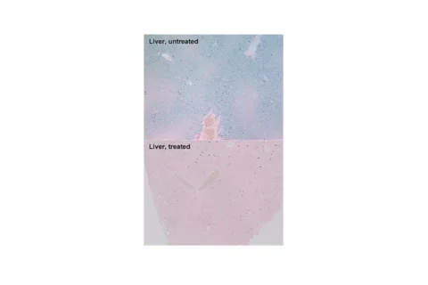 UCLA Scientists Develop Potential New Treatment for Iron-Overload Disorders.png