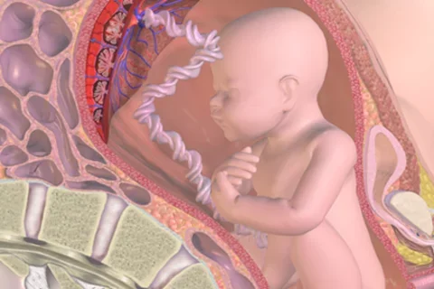 Genetic changes in placenta linked to poor fetal weight-gain, UCLA scientists find