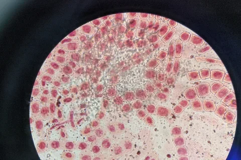 Cells under microscope 