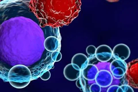 Low blood phosphate levels may be linked to neurological side effects from CAR T-cell therapy