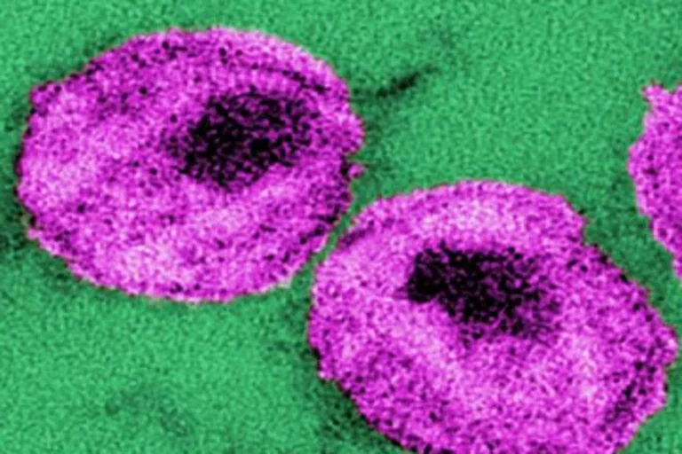 UCLA-led team refines ‘kick and kill’ strategy aimed at eliminating HIV-infected cells