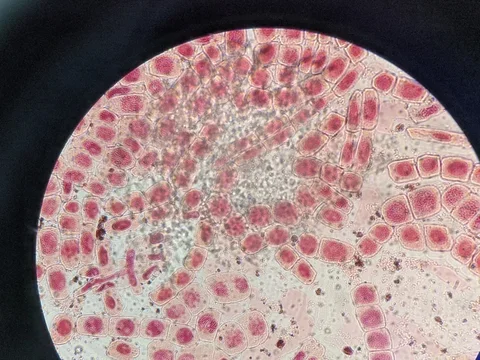 Cells under microscope 