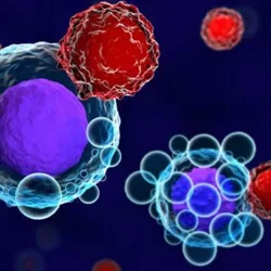 Low blood phosphate levels may be linked to neurological side effects from CAR T-cell therapy