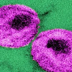 UCLA-led team refines ‘kick and kill’ strategy aimed at eliminating HIV-infected cells