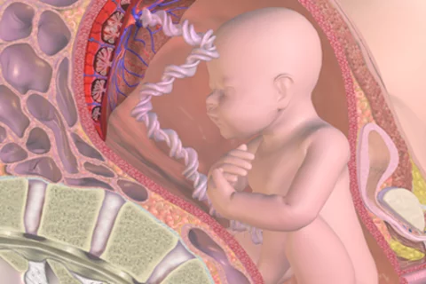 Genetic changes in placenta linked to poor fetal weight-gain, UCLA scientists find